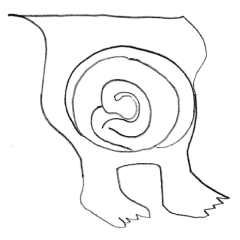 bowel-swirl